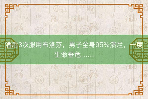 酒后3次服用布洛芬，男子全身95%溃烂，一度生命垂危……